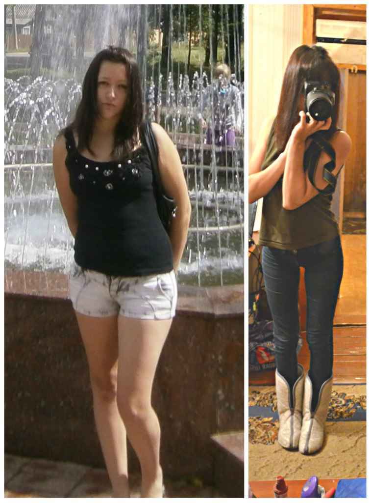 weight loss before and after pictures gallery online